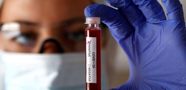 Κορωνοϊός: 1.044 νέα κρούσματα, 85 θάνατοι