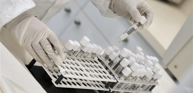 Ελληνική startup ετοιμάζει τεστ διάγνωσης